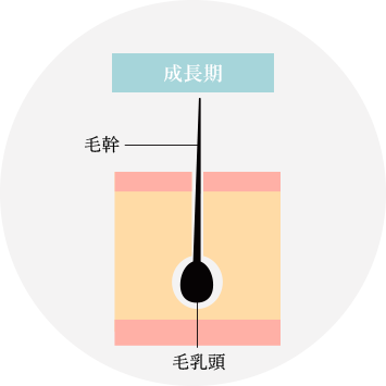  医療レーザー脱毛について